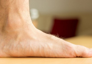 stopa płaska